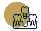Implante Dentário