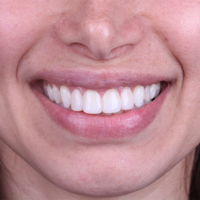 Estétical Dental